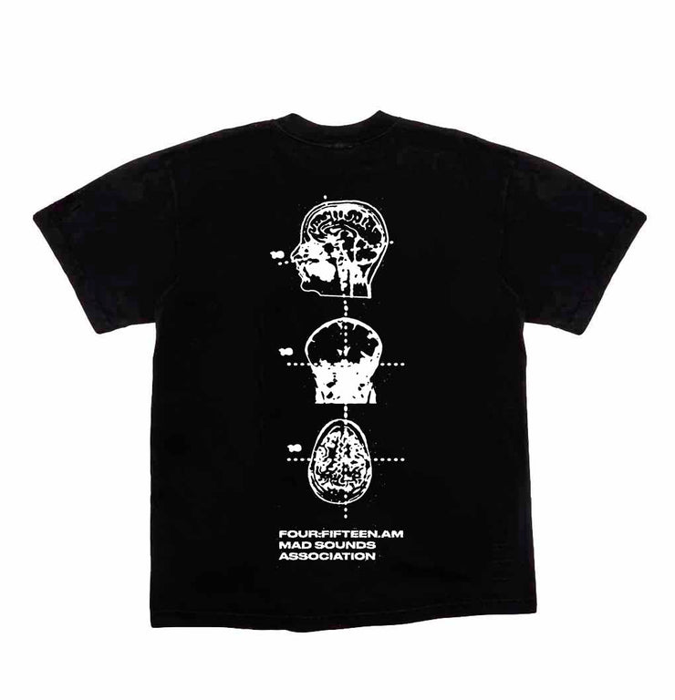 415AM BRAIN SCAN T-Shirt