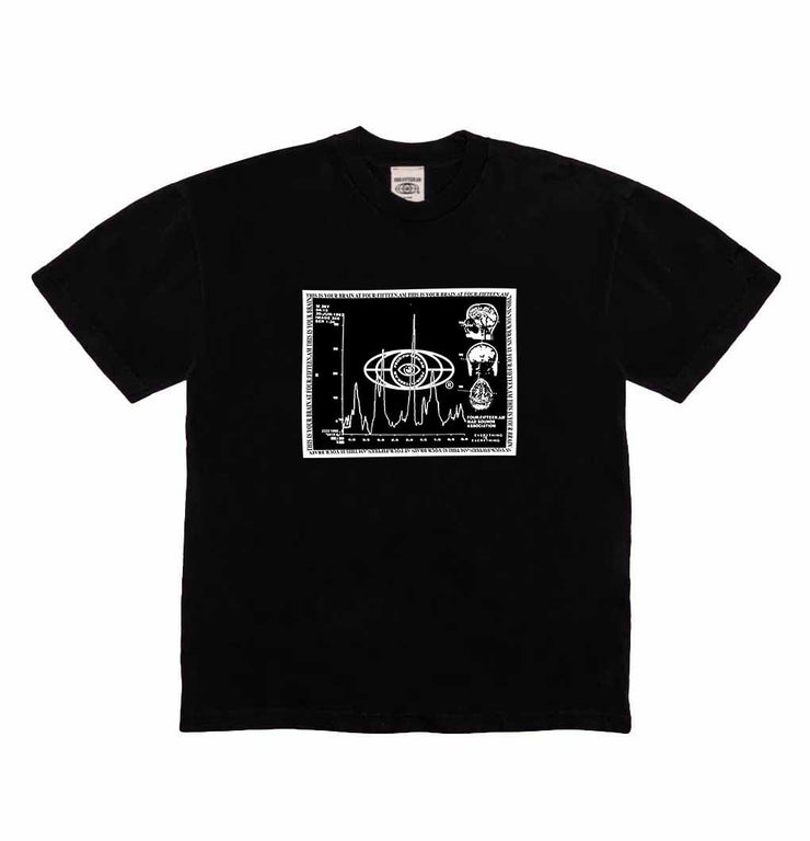 415AM BRAIN SCAN T-Shirt